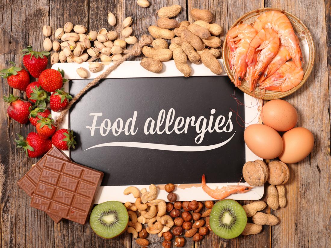 Food Allergies: What You Need To Know
